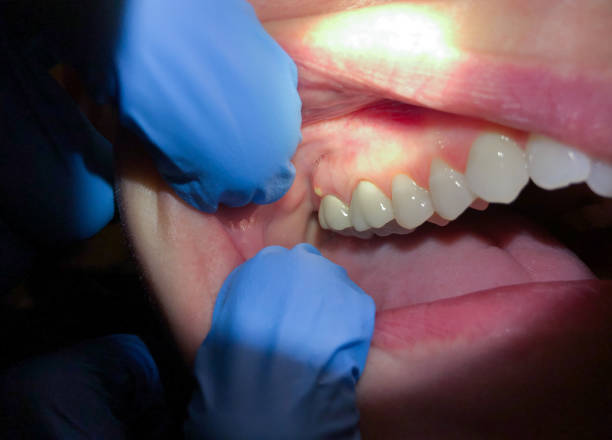Professional Emergency Dental Service in AL