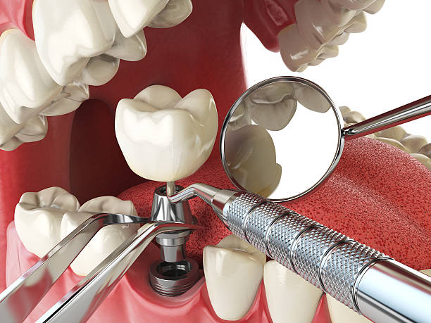 Best Broken or Chipped Tooth Repair in Adamsville, AL