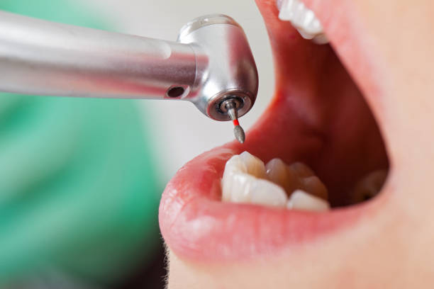 Best Emergency Treatment for Oral Infections in Adamsville, AL